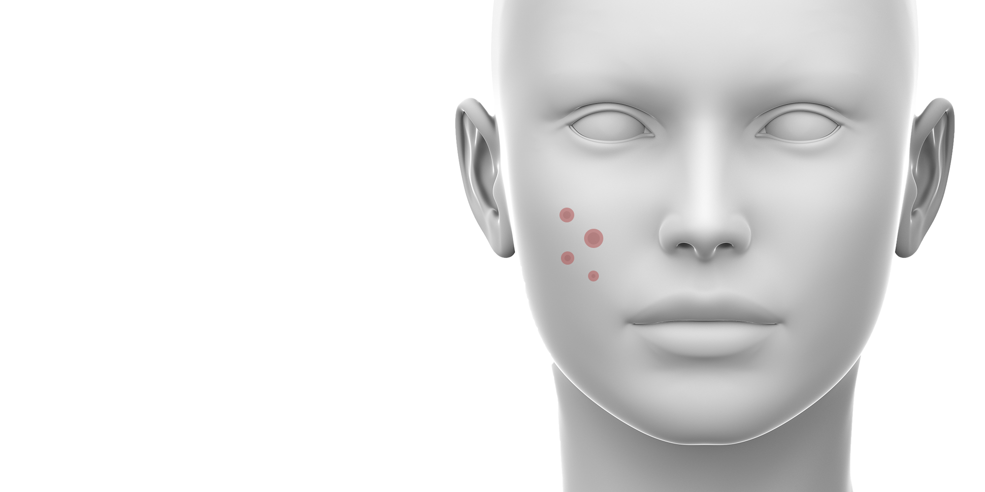 SKIN course - injectable skin rejuvenation