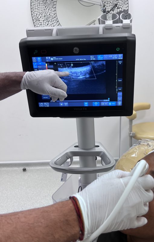 Ultrasound at DrBK - For patient safety in aesthetics