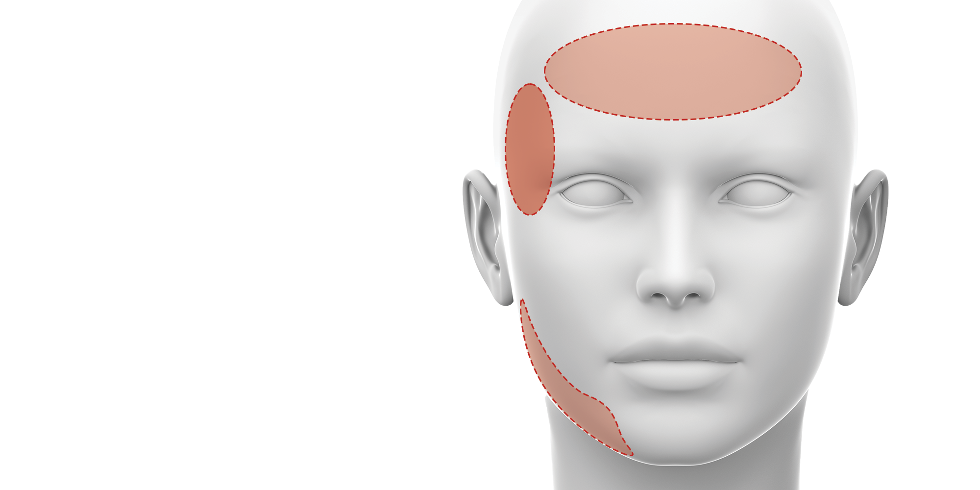 botulinum toxin for tmj related issues training