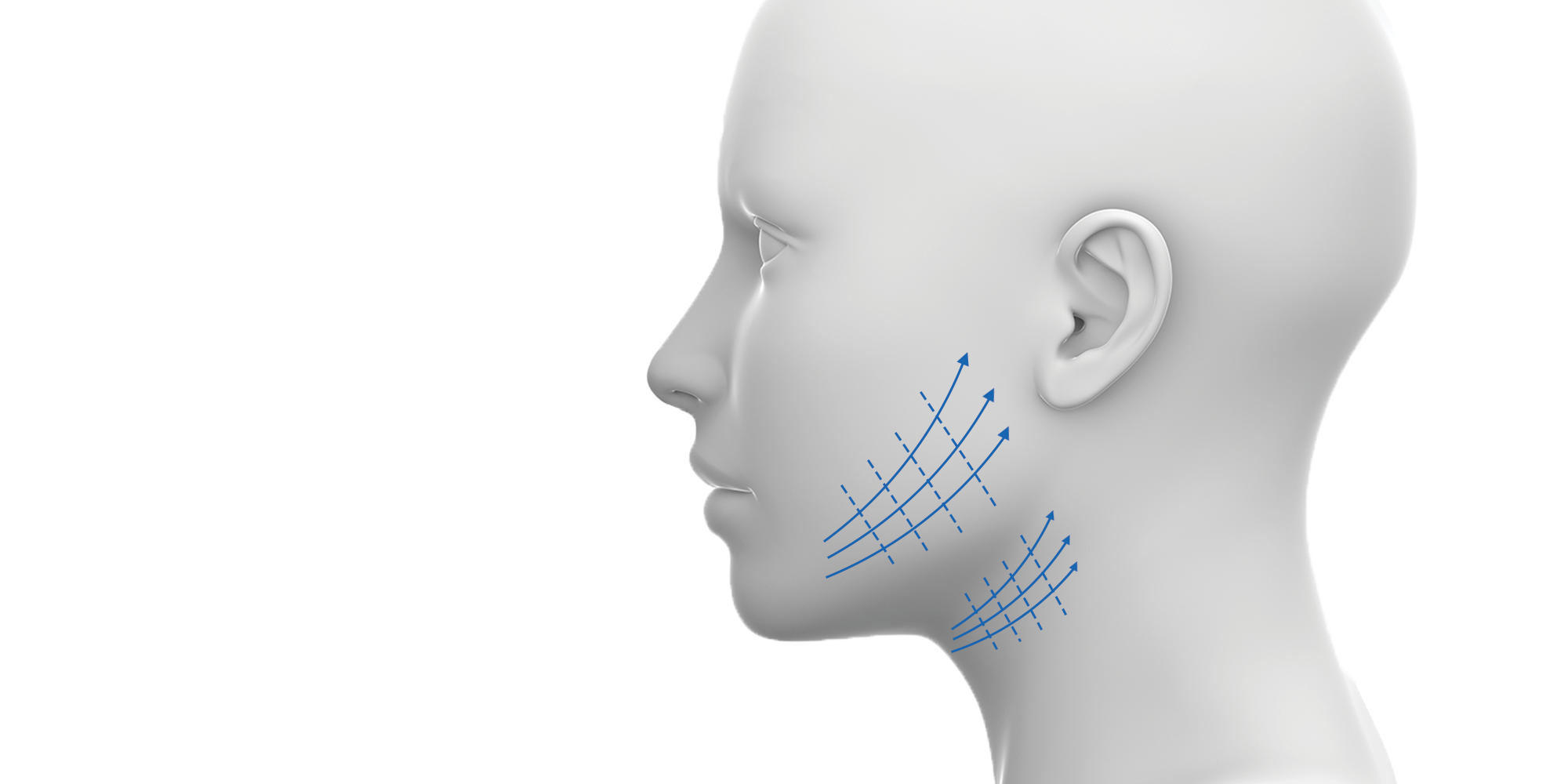 thread lift course - skin rejuvenation and skin tightening techniques