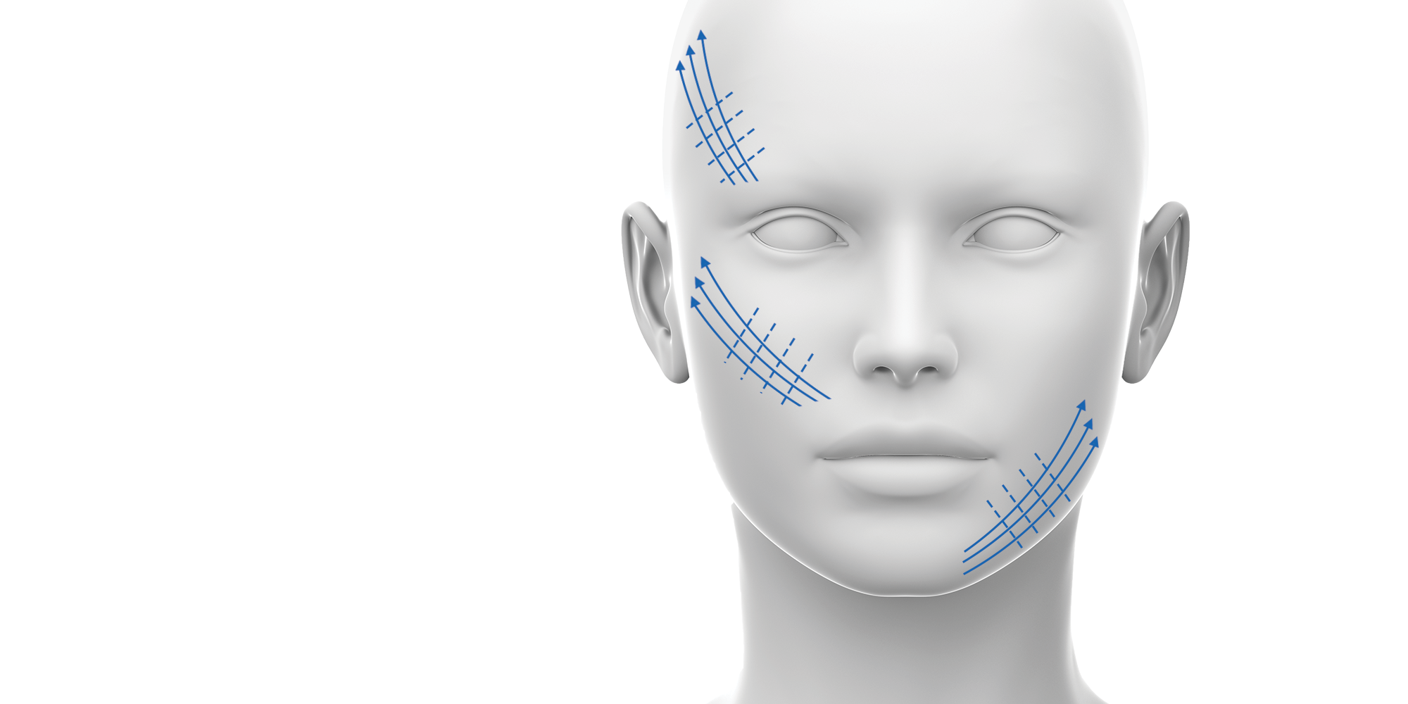 advanced thread lift course - the non surgical facelift